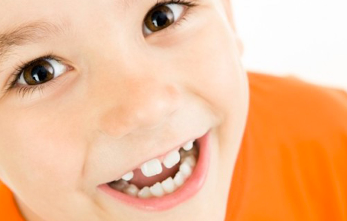 Perchè il bambino ha i denti storti? Come si può intervenire? 